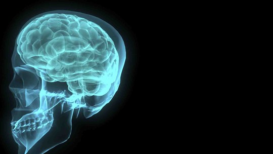 Cientistas identificam e tratam área do cérebro responsável por 'vozes' de esquizofrênicos